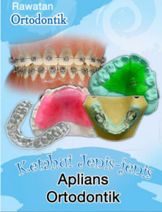Aplians Ortodontik